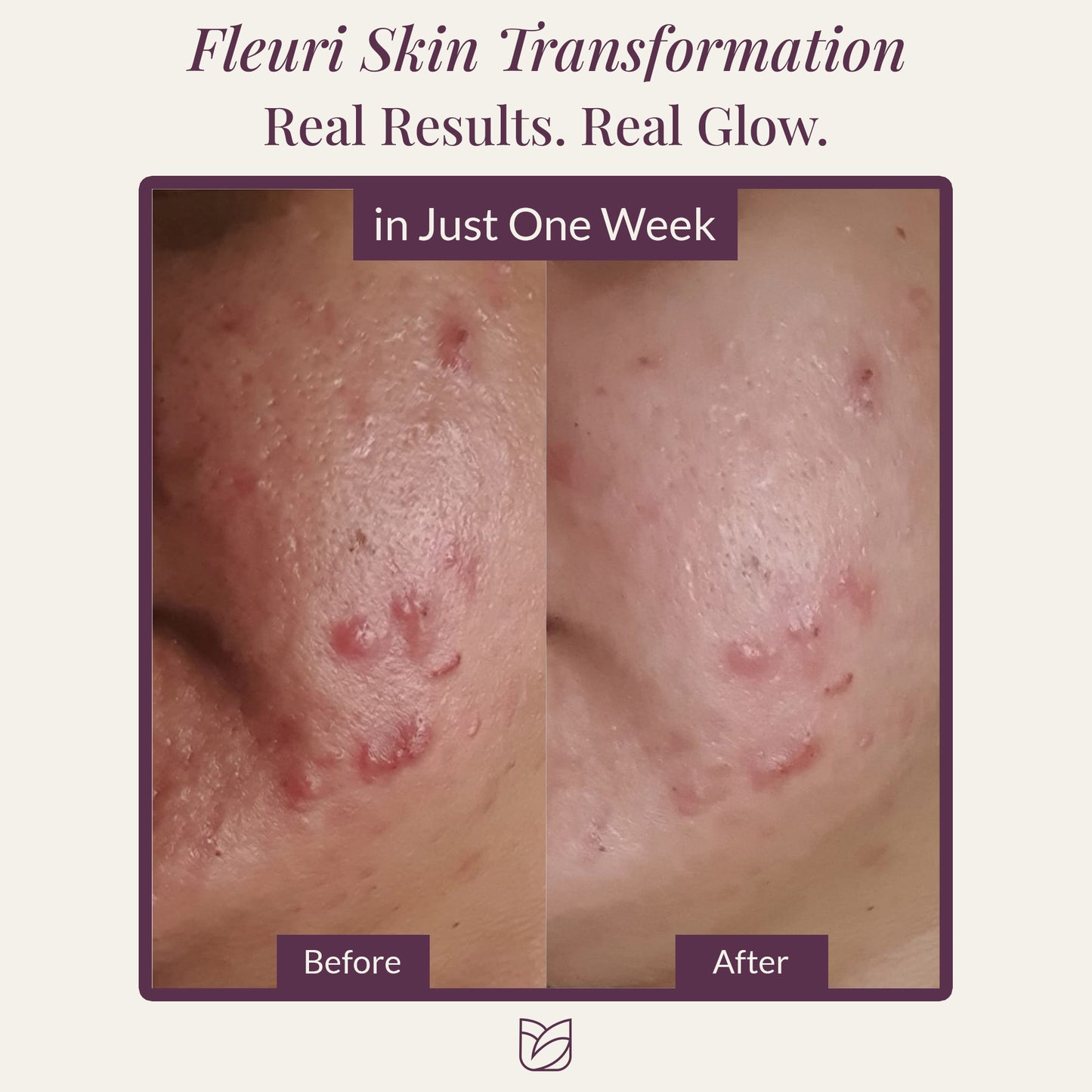 TriActive Serum
