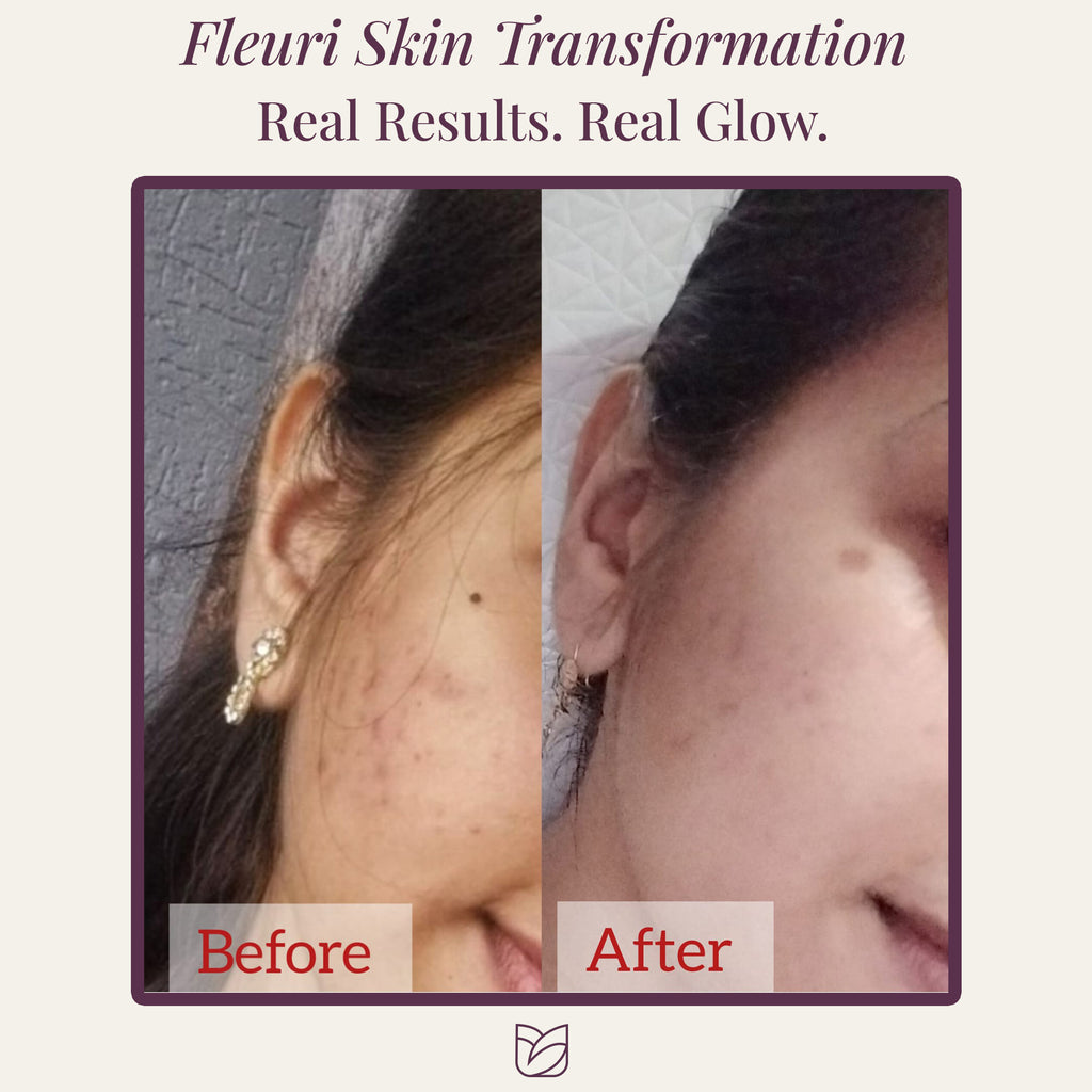 FleuriSkin Ultimate Glow Bundle – All-in-One Skincare Set