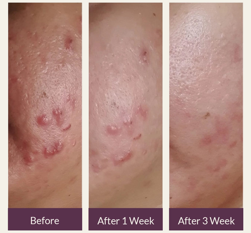 FleuriSkin Ultimate Glow Bundle – All-in-One Skincare Set